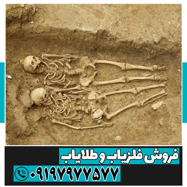 وجود استخوان در گنج یابی