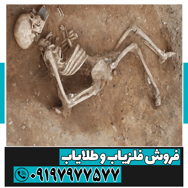 وجود استخوان در گنج یابی